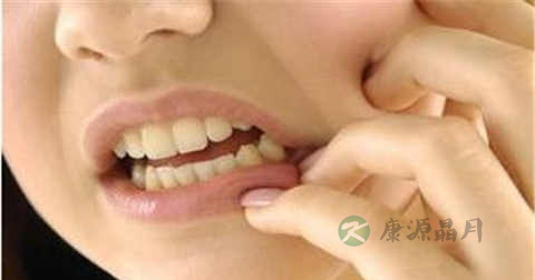早期蛀牙能治好吗 早期蛀牙能治好吗