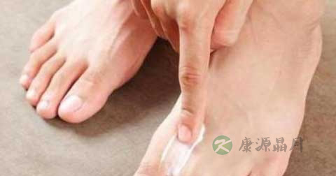 瘊子怎么去除 瘊子怎么去除