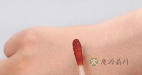 皮肤损伤要怎么护理 皮肤损伤要怎么护理