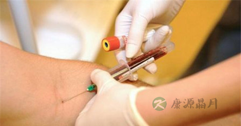 乙肝两对半25阳性怎么办 乙肝两对半25阳性怎么办