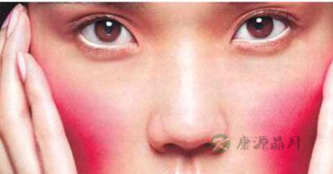 高原红怎么治 高原红怎么治