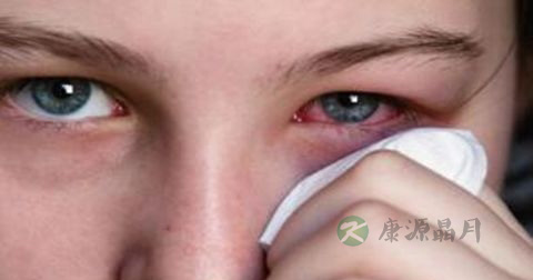 红眼病如何预防复发 红眼病如何预防复发