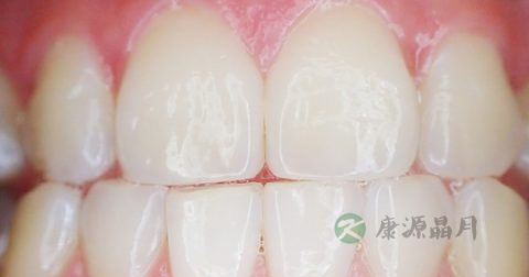 口中有hsv病毒吗 口中有hsv病毒吗