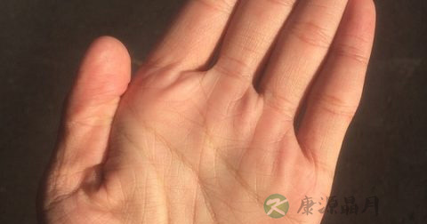 鹅掌风传染吗