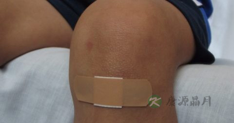 被猫抓破了怎么办 被猫抓破了怎么办