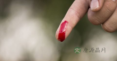 被蜈蚣咬了怎么急救 被蜈蚣咬了怎么急救