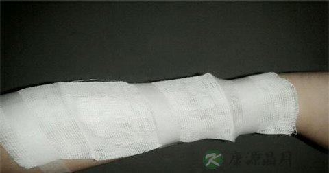 胳膊摔断了怎么急救 胳膊摔断了怎么急救