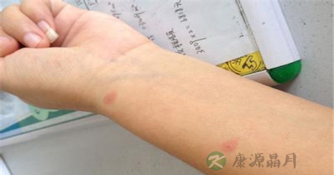 胳膊摔断了怎么急救 胳膊摔断了怎么急救
