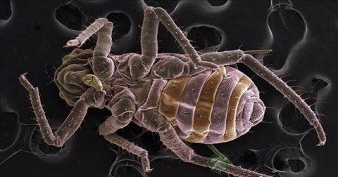 寄生虫高温能杀死吗 寄生虫高温能杀死吗
