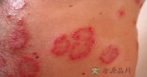 小儿通气鼻贴多大可以用