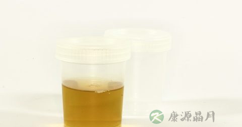 钙定性检测试剂盒使用方法