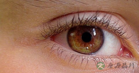 糖尿病眼病的早期症状 糖尿病眼病的早期症状
