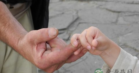 结缔组织病的原因 结缔组织病的原因