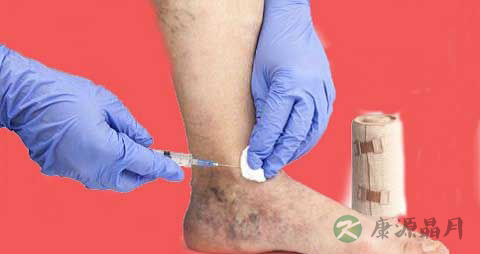 血栓闭塞性脉管炎吃什么药 血栓闭塞性脉管炎吃什么药