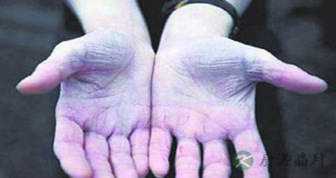 法洛四联症不能吃什么，法洛四联症的注意事项