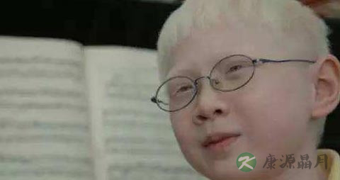 白化病人可以配眼镜吗