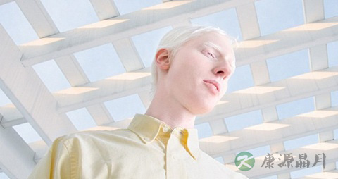 眼皮肤白化病怎么办