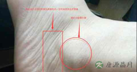 脚外踝疼是怎么回事 脚外踝疼是怎么回事