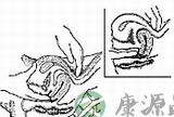 高清实拍妇科检查:撑开阴道检查 高清实拍妇科检查:撑开阴道检查