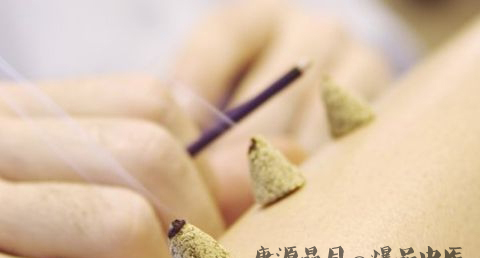 夏至节气如何艾灸 夏至节气如何艾灸