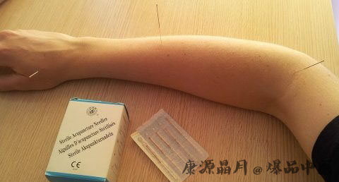 三伏天适合艾灸吗 三伏天适合艾灸吗