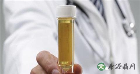 酱油尿是什么原因引起的 酱油尿是什么原因引起的