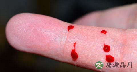 在哪能买到hiv检测试纸 在哪能买到hiv检测试纸