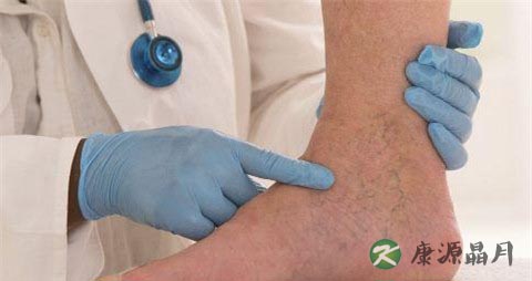 跟腱炎症状 跟腱炎症状