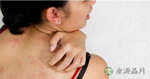 湿诊如何治疗 湿诊如何治疗