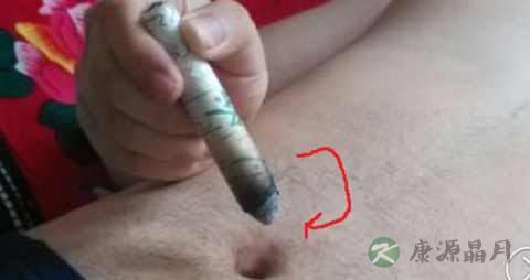 艾灸肚脐出水是什么原因 艾灸肚脐出水是什么原因