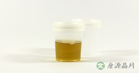 吃煮花生治肾病的偏方