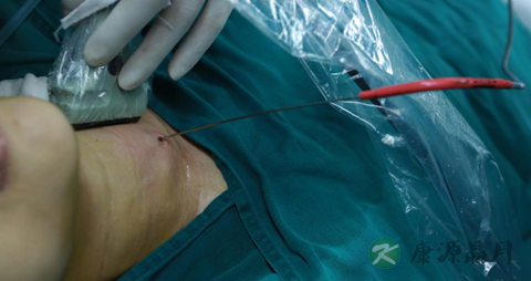 甲状腺肿瘤严重吗 甲状腺肿瘤严重吗