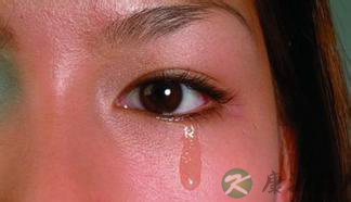 迎风流泪需小心 或肾阴虚所致 迎风流泪需小心 或肾阴虚所致