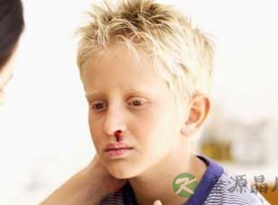 小孩流鼻血!4大处理办法须谨记 小孩流鼻血!4大处理办法须谨记
