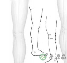 治疗风湿的方法 采取穴道按摩或穴道指压法 治疗风湿的方法 采取穴道按摩或穴道指压法