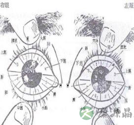 中医特色眼针疗法 眼针疗法又是如何取穴的 中医特色眼针疗法 眼针疗法又是如何取穴的