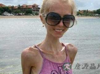 李咏13岁女儿婴儿肥甜美 青春期过度减肥要不得 李咏13岁女儿婴儿肥甜美 青春期过度减肥要不得