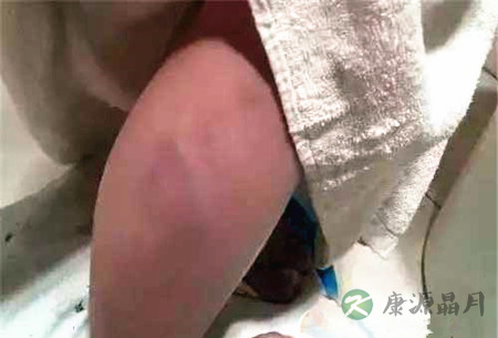 孩子考试没到80分遭老师毒打 拍照留证据可维权 孩子考试没到80分遭老师毒打 拍照留证据可维权