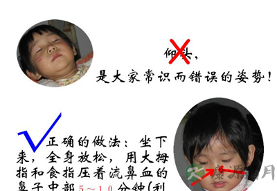 秋燥宝宝易流鼻血 鼻子塞纸巾不能止血 秋燥宝宝易流鼻血 鼻子塞纸巾不能止血