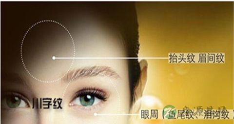 皱纹形成的原因_皱纹是怎么引起的 皱纹形成的原因_皱纹是怎么引起的
