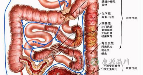 肠息肉 肠息肉