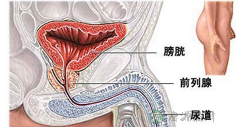 睾丸癌
