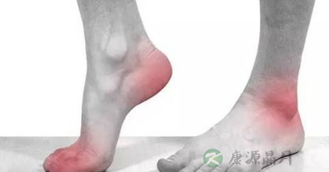 筋膜炎