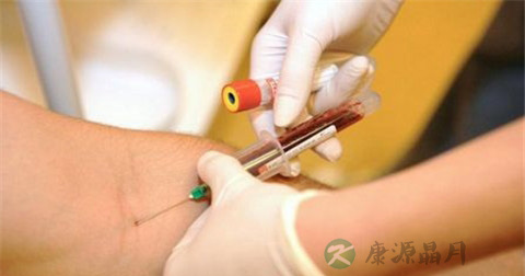 红细胞沉降率