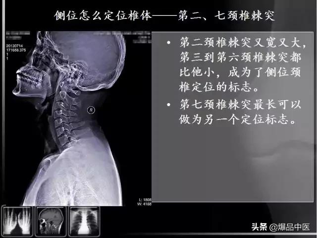 颈椎阅片的基础知识