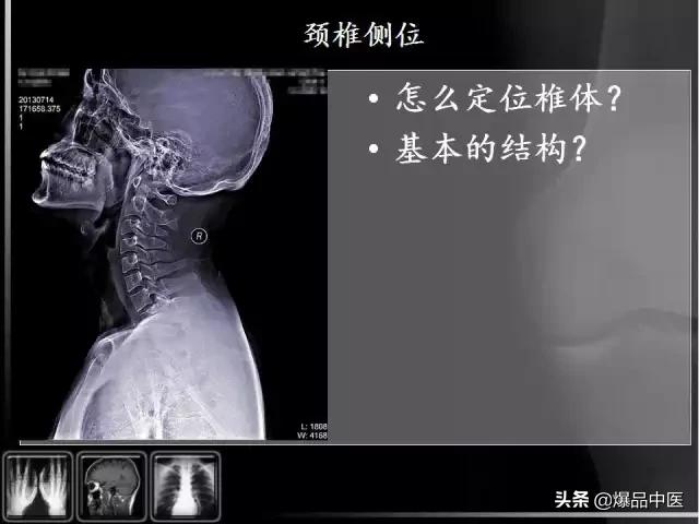颈椎阅片的基础知识