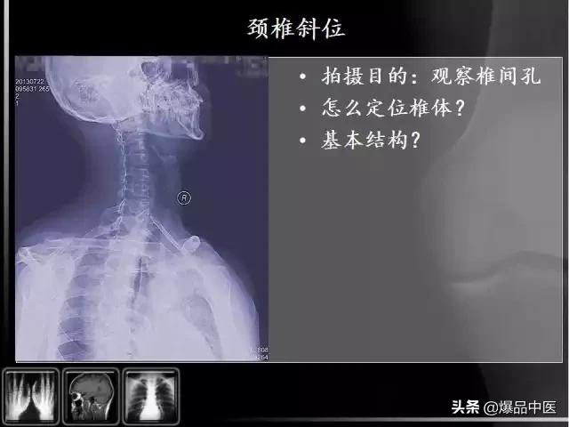 颈椎阅片的基础知识