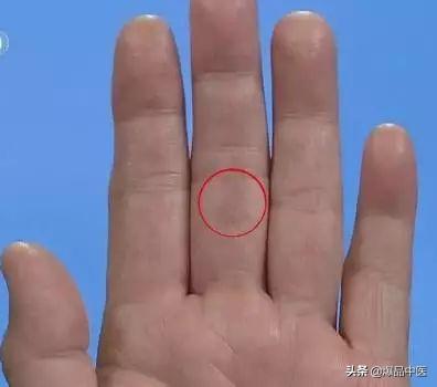 手是健康的镜子，10种常见病，从手上就能看出来