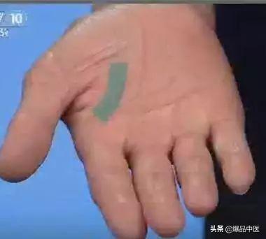 手是健康的镜子，10种常见病，从手上就能看出来