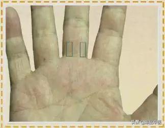 手是健康的镜子，10种常见病，从手上就能看出来